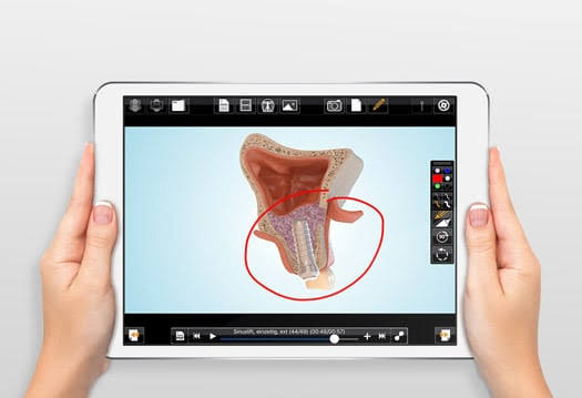 modernste Patientenaufklärung mit Synmedico