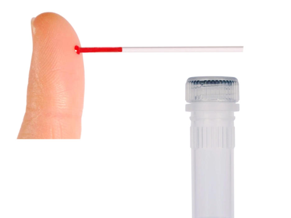 Pritiskajte na konico prsta, dokler se ne pokaže kapljica krvi. S stekleno kapilarno cevko se nato previdno dotaknite kapljice krvi in počakajte, da se cevka napolni približno do polovice.