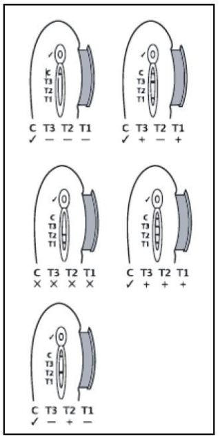 Allergo CHECK interpretacija rezultatov.
