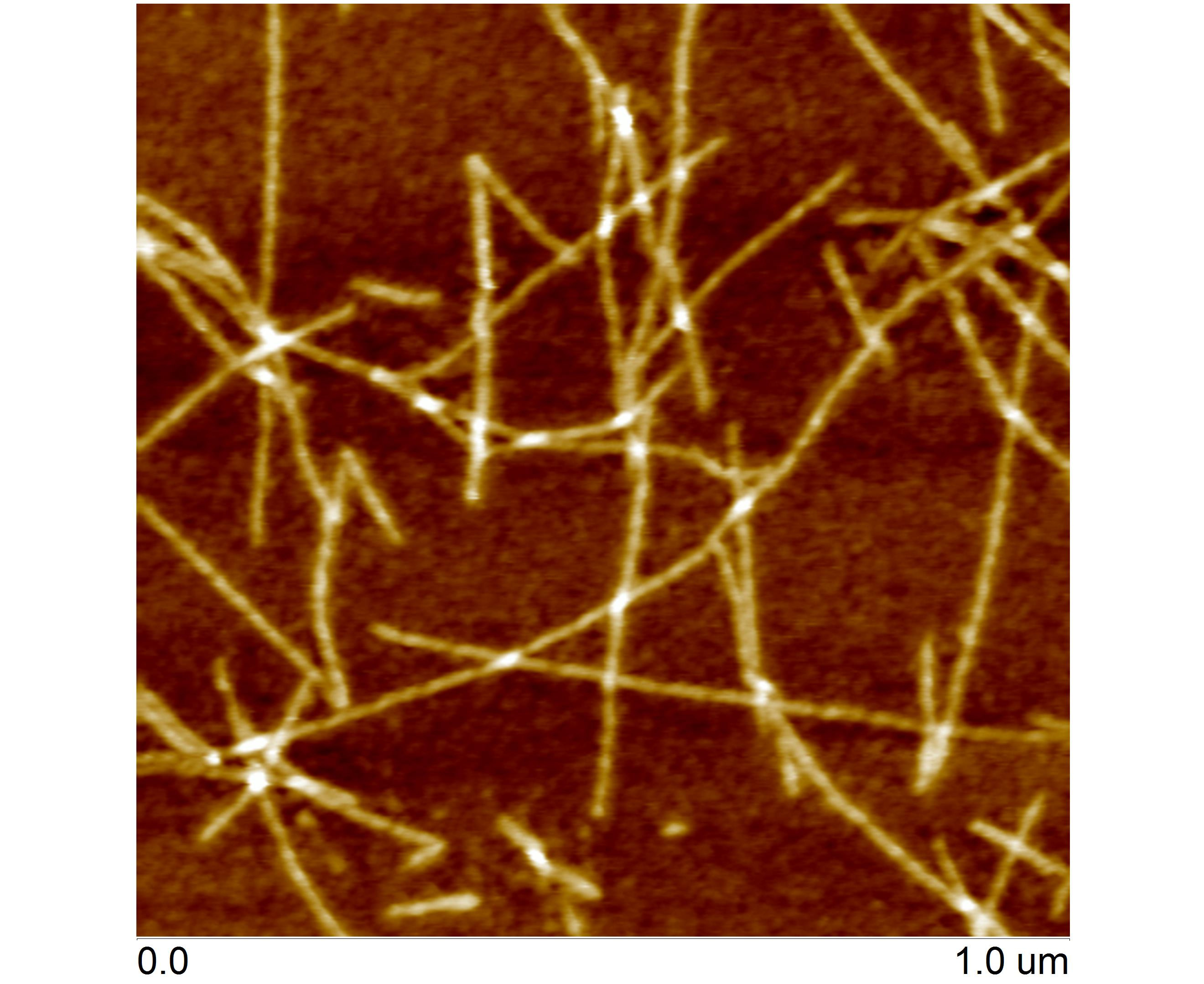 Fibrils of human stefin B