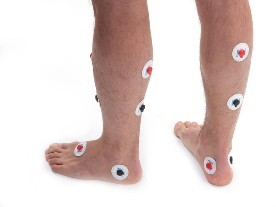 FREMS: Vaskulopatija