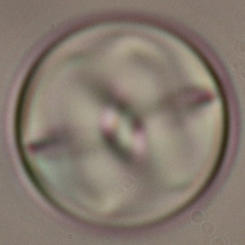 Quenched chiral nematic droplets can be populated with diverse defect states.