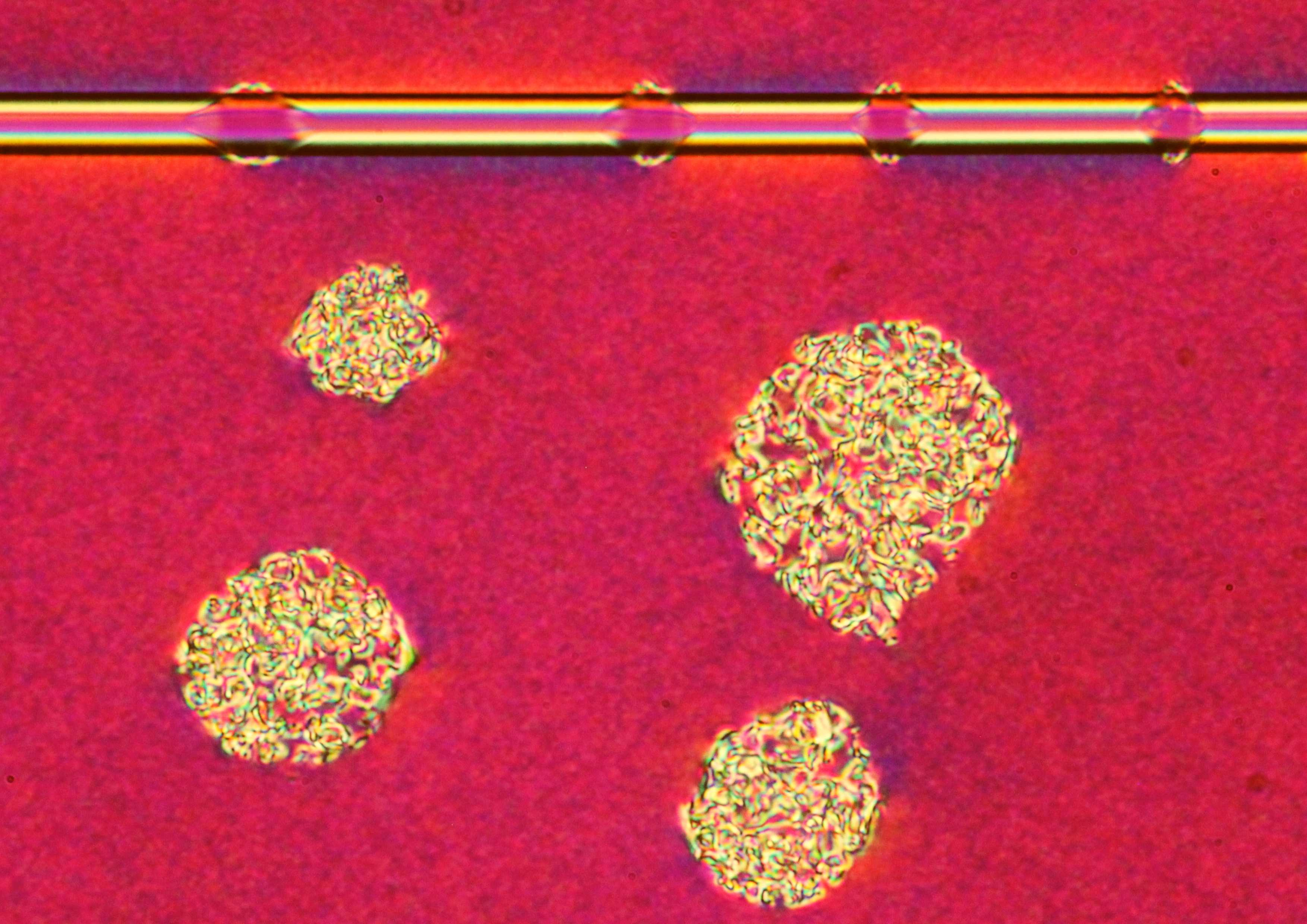 Topological defects on a fibre