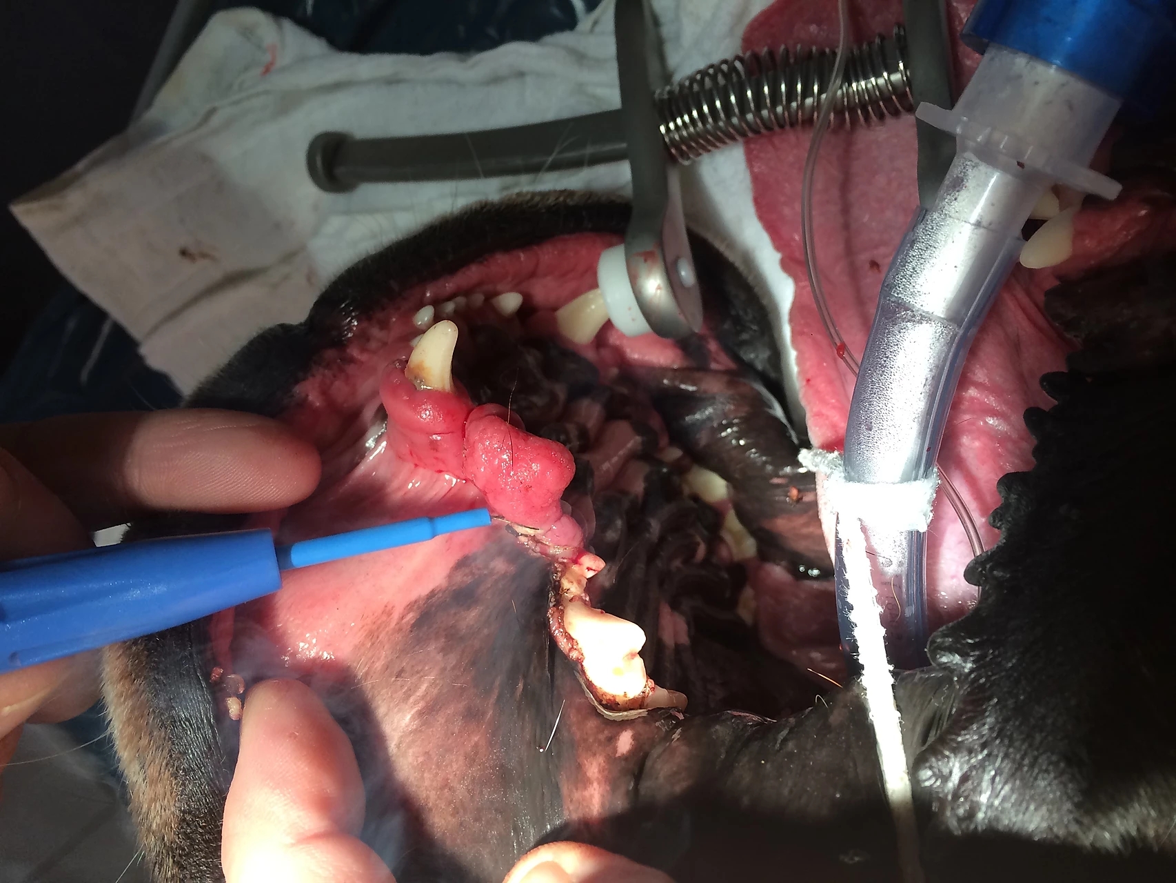 Maulhöhlensanierung
bei Zahnfleischhyperplasie