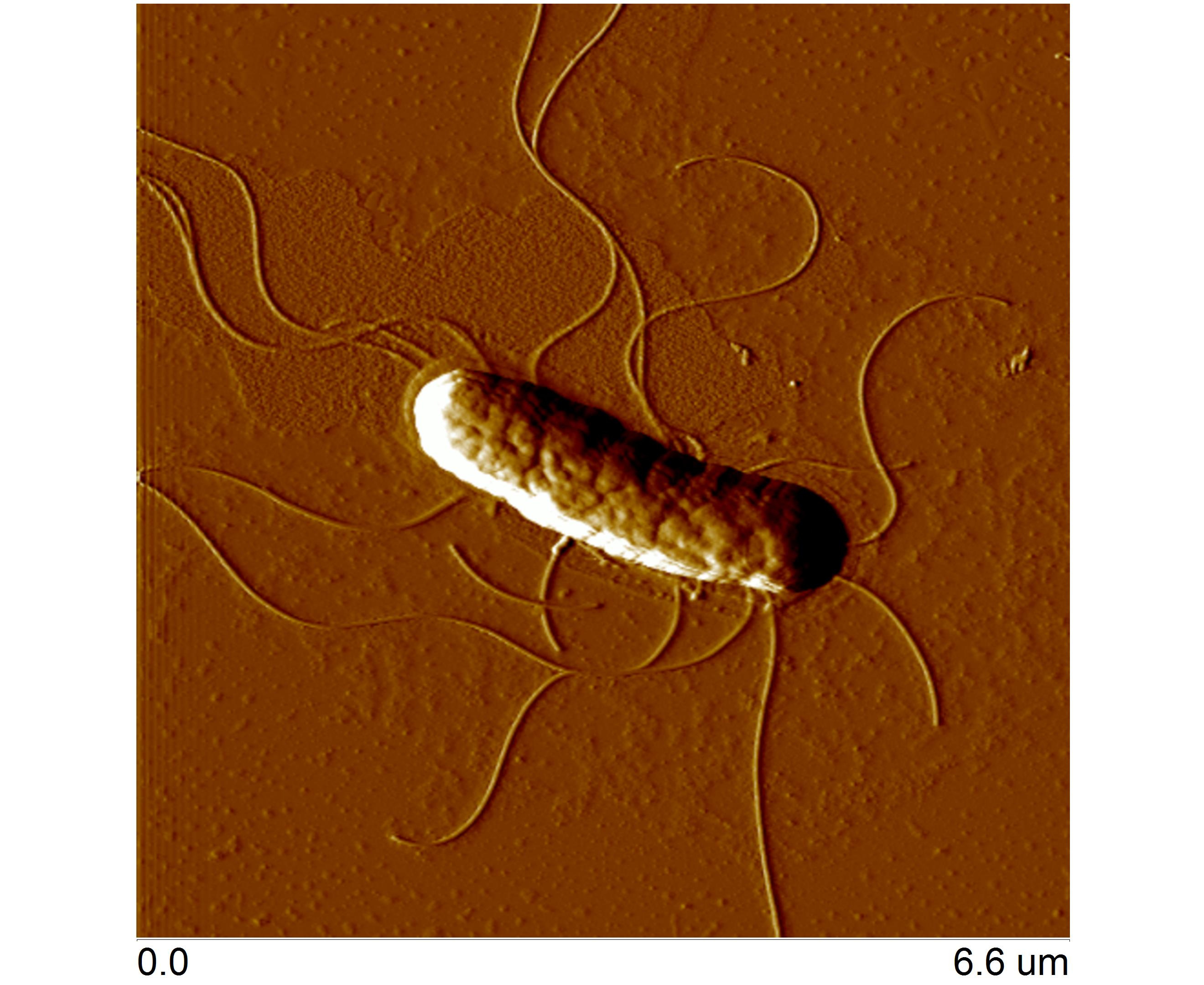 Escherichia Coli
